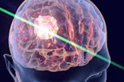Best Neurosurgery Hospital in Chennai | Expert Neurosurgeon