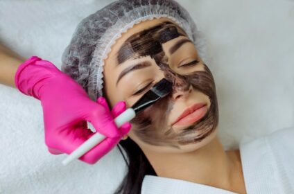 Carbon Facial in Dehradun