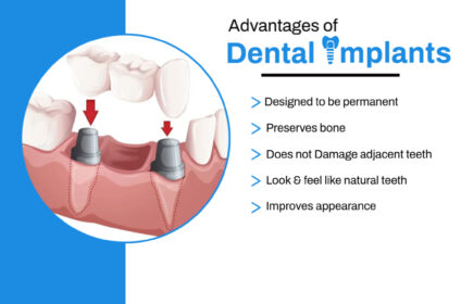 Kapoor Dental Care Center Gill Road