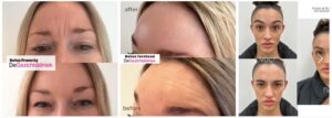 De Gezichtskliniek - AWARD-WINNING BOTOX, FILLERS, MEDICAL SKINCARE & MEDISCH AFVALLEN