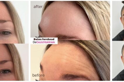 AWARD-WINNING BOTOX, FILLERS, MEDICAL SKINCARE & MEDISCH AFVALLEN