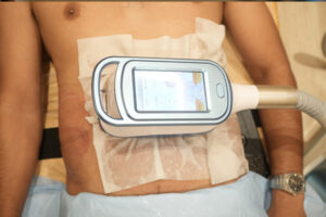 Fat Freezing Clinic