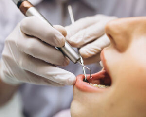 Dental Clinic in Ludhiana