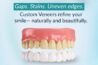 Dr. Tooth Smile Centre | Dental Clinic - Dr. Esha