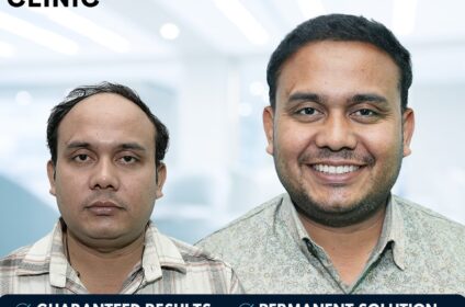 Bhopal Hair Clinic