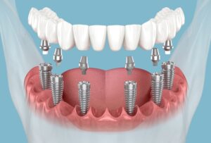 The Dental Wellness Centre