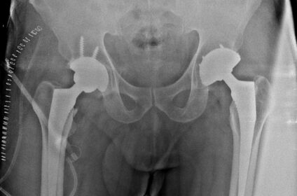 Dr Abhijit More- Orthopedic Doctor