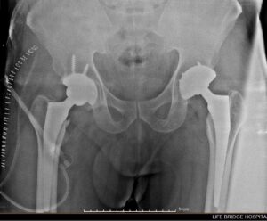 Dr Abhijit More- Orthopedic Doctor in Pimple Saudagar