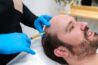 PRP Treatment in Delhi