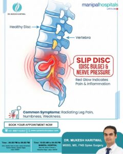 Dr Mukesh Haritwal - Spine Surgeon in Jaipur, micro spine doctor in Jaipur, Slip Disc Treatment in Jaipur