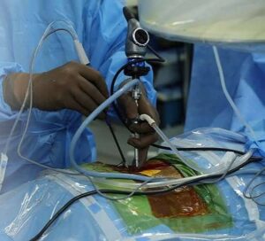 Dr. Utkarsh Agrawal- Spine Surgeon