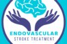 stroke centre