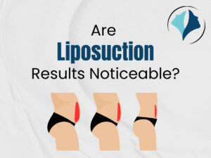 Essence Cosmetic Surgery Clinic