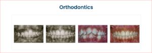 Devs Oral Care - Dentist in Camp, Pune | Teeth Cleaning, Whitening,