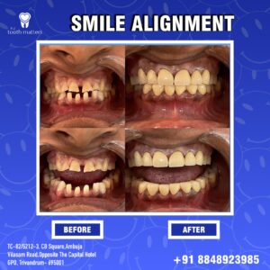 P S Tooth Matters | Dental clinic in Pulimoodu, Trivandrum