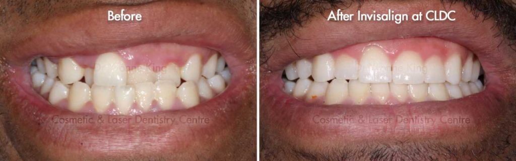 Cosmetic Dentist in Melbourne | Cosmetic & Laser Dentistry