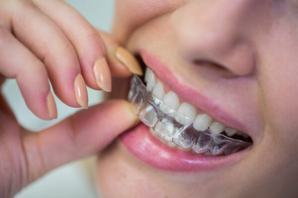 Cosmetic Dentist in Melbourne | Cosmetic & Laser Dentistry