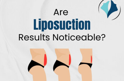 Essence Cosmetic Surgery Clinic