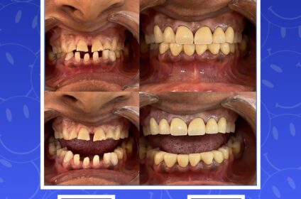 P S Tooth Matters | Dental clinic in Pulimoodu, Trivandrum