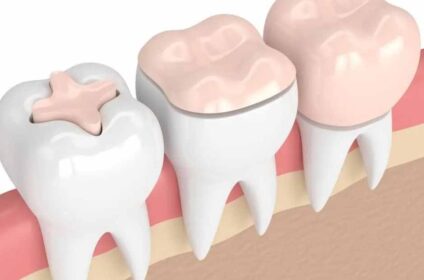 Dental Clinic Melbourne – Healthy Smiles Dental Group