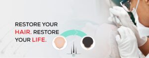 Clion Care Hair Transplant Clinic