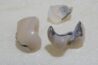 Milcovich Dental Arts