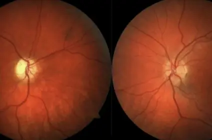 Eye Stem Cell Center