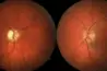 Eye Stem Cell Center