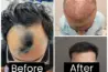 Rejuvenare Dermatology Clinic by Dr. Shobhit