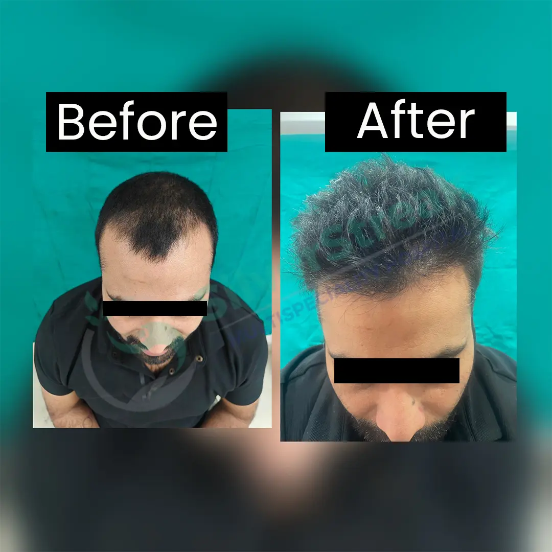 Rejuvenare Dermatology Clinic by Dr. Shobhit