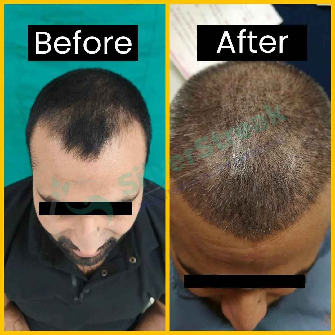 Rejuvenare Dermatology Clinic by Dr. Shobhit