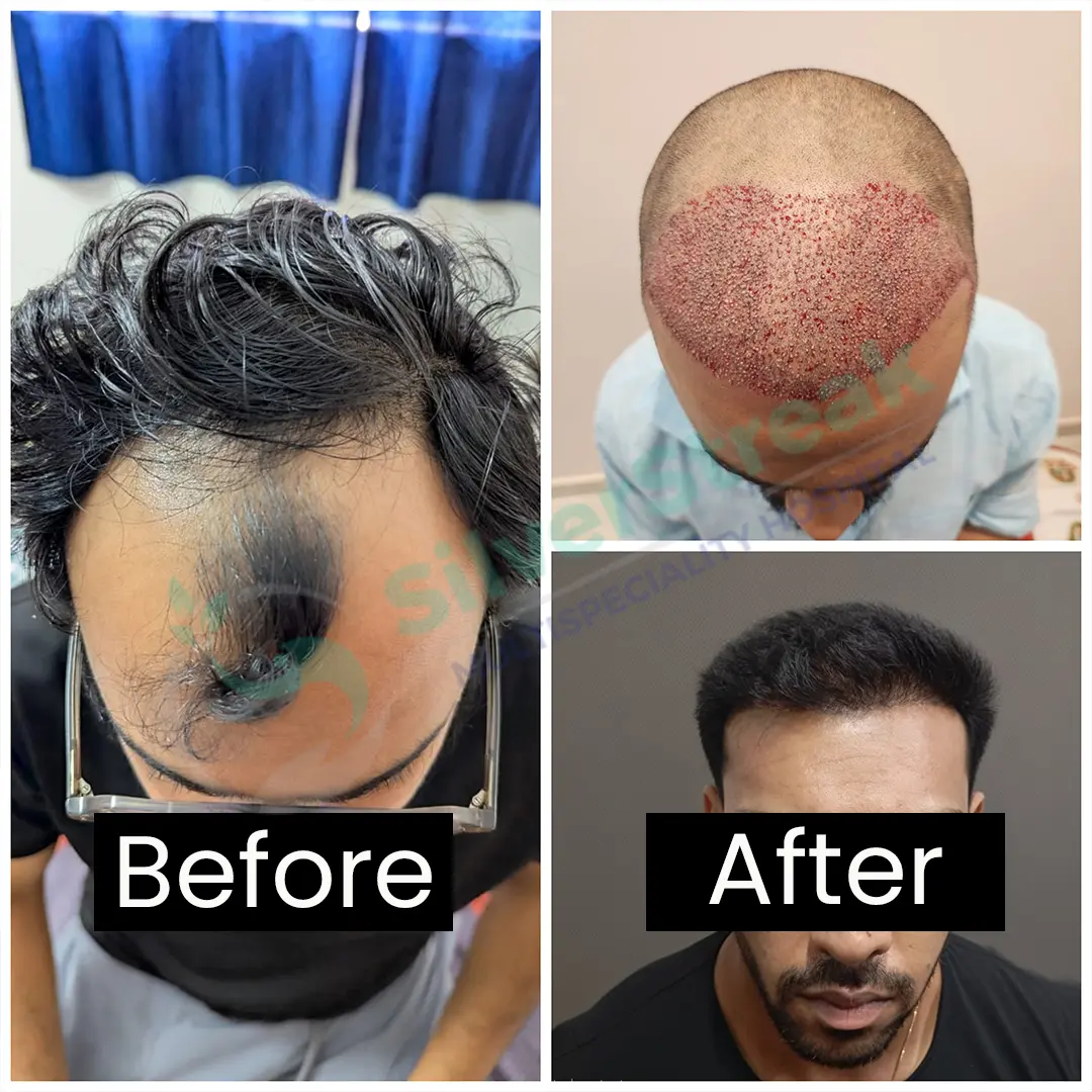 Rejuvenare Dermatology Clinic by Dr. Shobhit